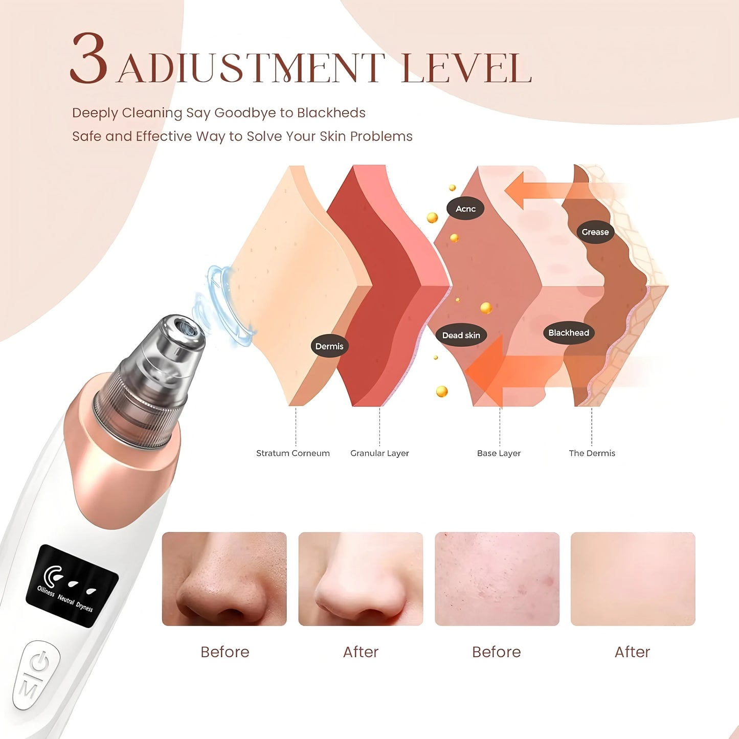 Rechargeable Blackhead Remover Face Vacuum Cleaner – Electric Nose Pore Cleaner & Acne Extractor for Women