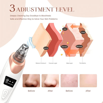 Rechargeable Blackhead Remover Face Vacuum Cleaner – Electric Nose Pore Cleaner & Acne Extractor for Women